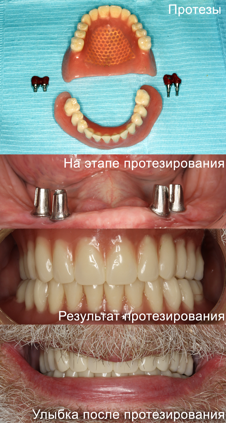 Качественное наращивание ресниц отзывы Качественное наращивание ресниц отзывы