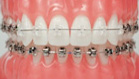 www.dentideal.ru/articles/ispravlenie_prikusa/